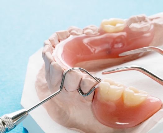 A closeup of a partial denture set on a jaw mockup